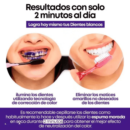 Blanqueador Dental - Smilekit Booster®