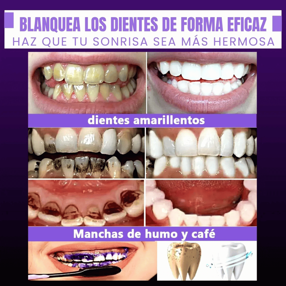 Blanqueador Dental - Smilekit Booster®