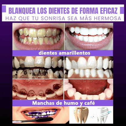 Blanqueador Dental - Smilekit Booster®